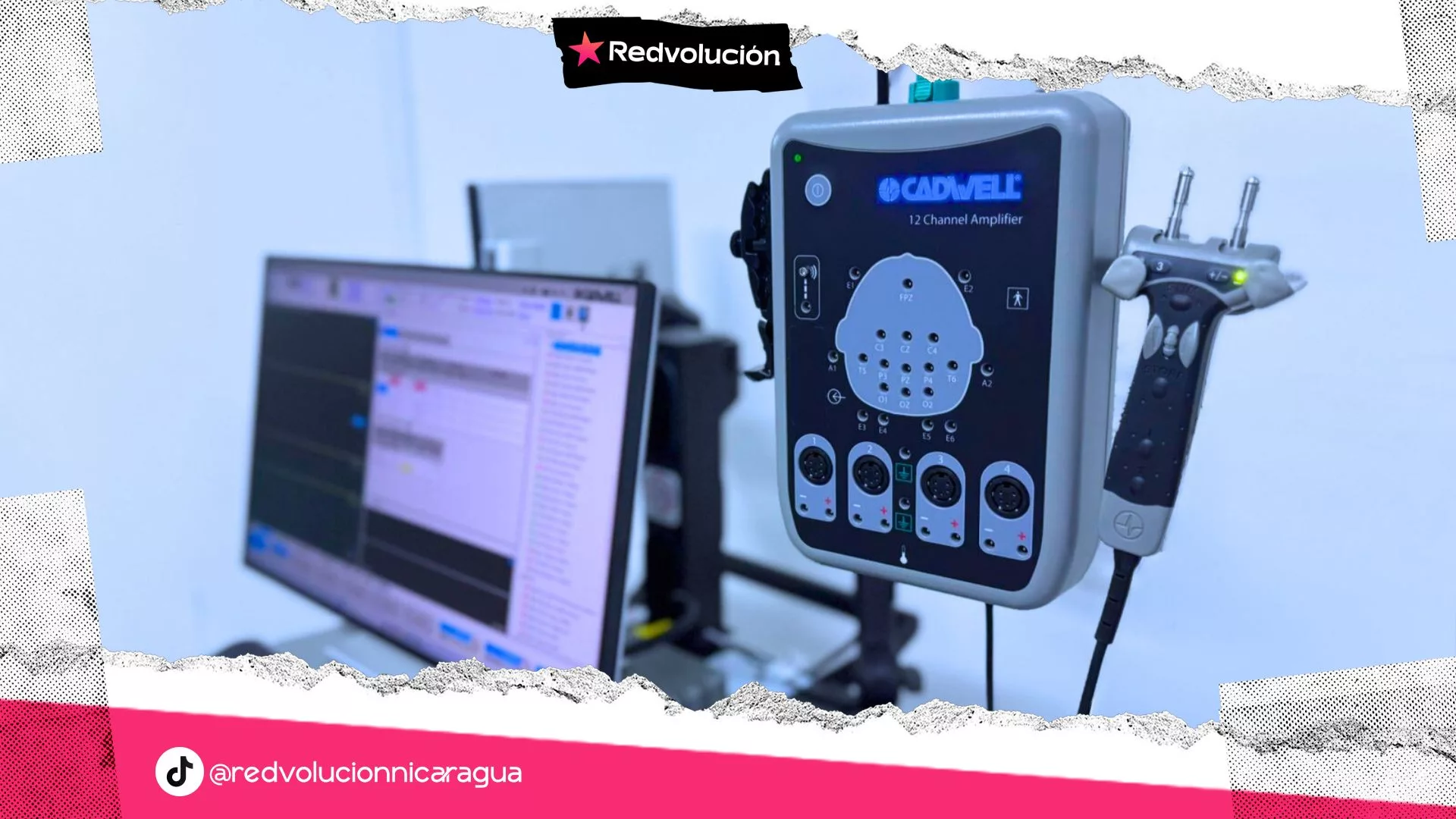 NICARAGUA ENTREGA DE EQUIPOS DE ELECTROENCEFALOGRAMAS