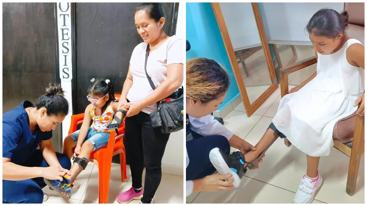 Con prótesis y rehabilitación, la Revolución Popular Sandinista transforma vidas