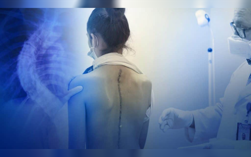 Especialistas de SpineHope y médicos nicaragüenses operarán a pacientes con afecciones de columna